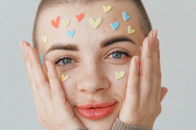 Acne: A New Perspective
