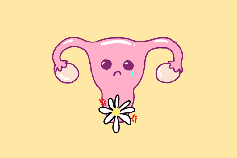 What to Do: Yeast Infections