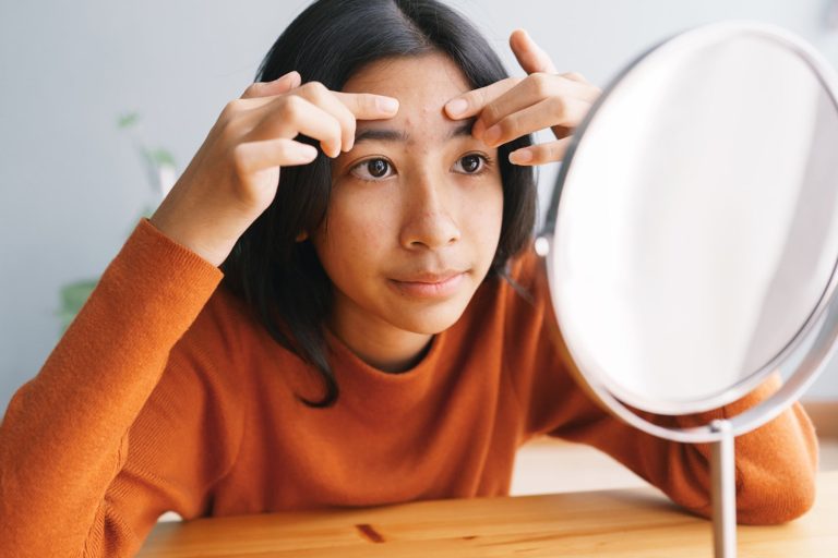 Hands Off! Don’t Pick Those Zits