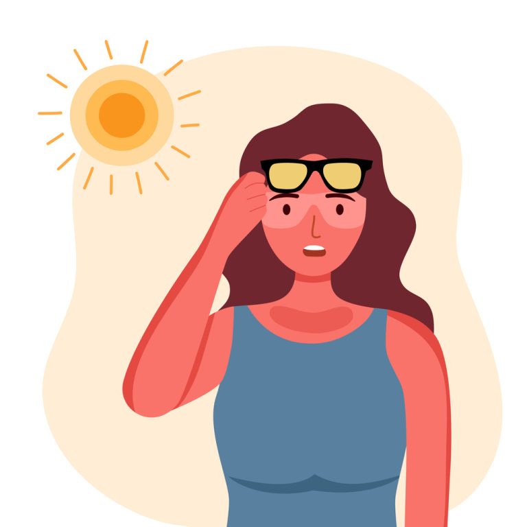 What to do after getting sunburned!
