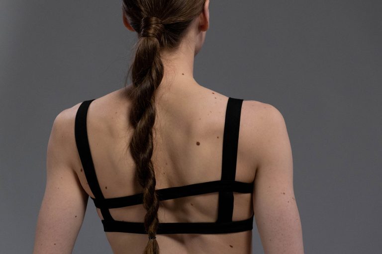 Moles: When to Get Checked Out